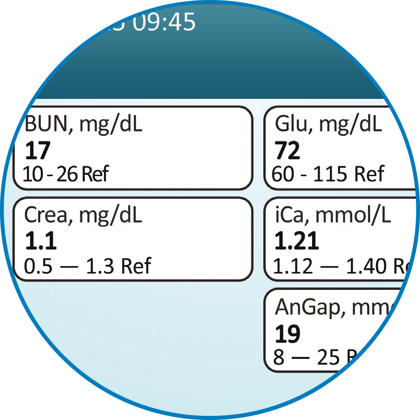 VS2_step3 Read results