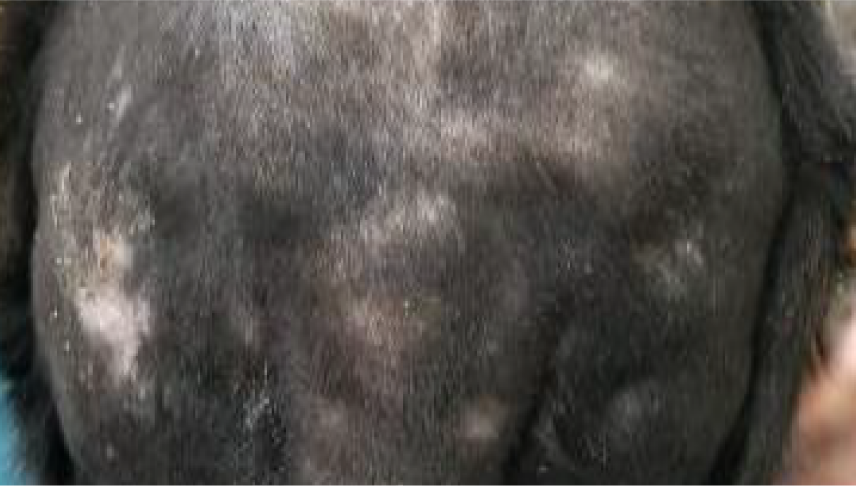 DOPO image